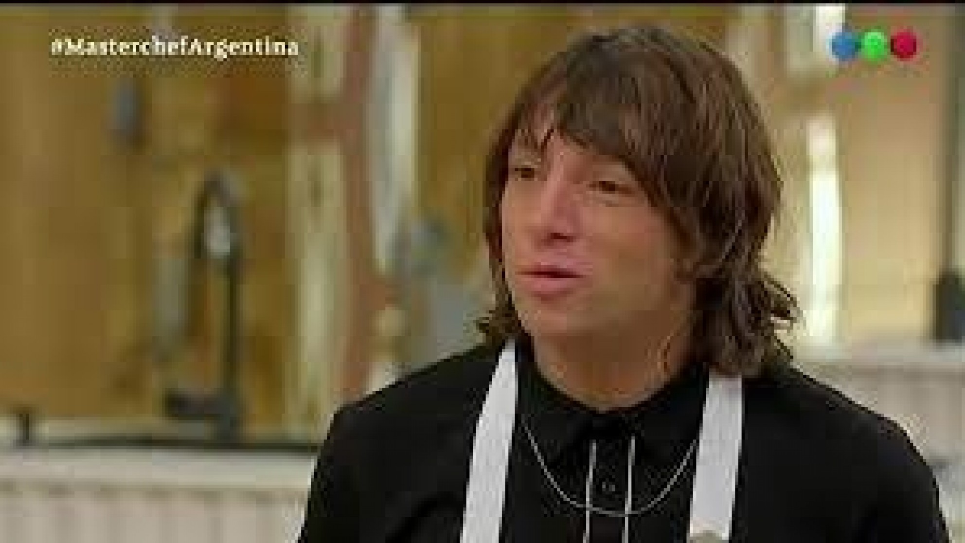 El áspero accidente del cantante de Turf en Masterchef